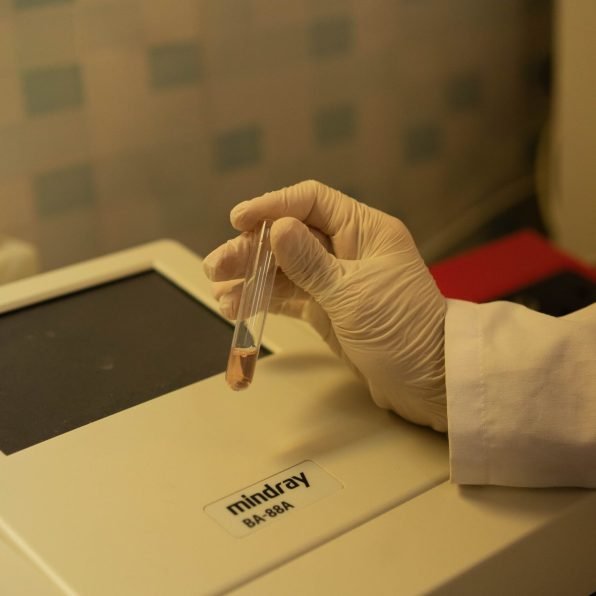 Lab technician's gloved hand holding a vial near a semi-automatic chemistry analyzer.