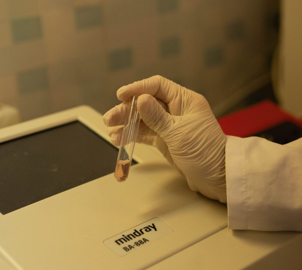 Lab technician's gloved hand holding a vial near a semi-automatic chemistry analyzer.